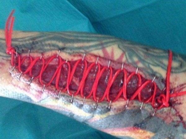 Arm verwoest door hond: schadeclaim tegen politie